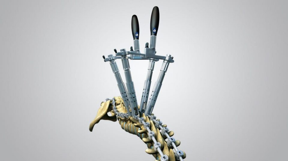 Firebird Deformity Secondary 960x538